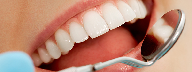 Dental Hygiene Thornhedge Dental