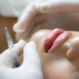 Dermal Fillers & Anti-Wrinkle