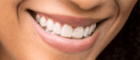 Invisalign_clear_mould